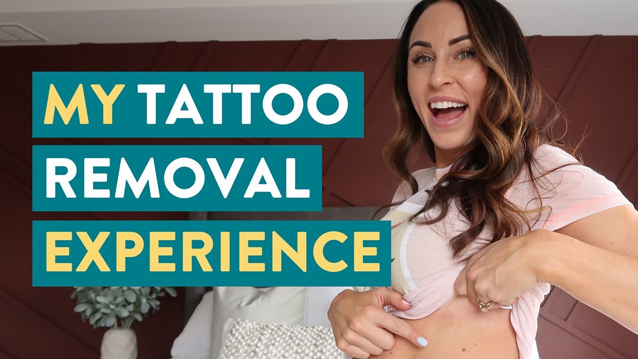 My Tattoo Removal Experience - Tattoo Removal Before And After - Juli Bauer Roth