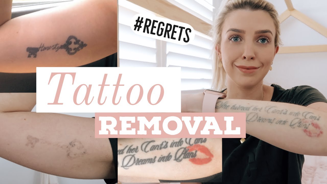 LASER TATTOO REMOVAL/ Before & After/ Best Laser/ COST, PAIN and WHY I'm removing them!